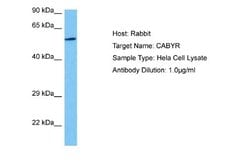 CABYR Antibody, Novus Biologicals 100 &mu;L | Buy Online | Novus Biologicals | Fisher Scientific